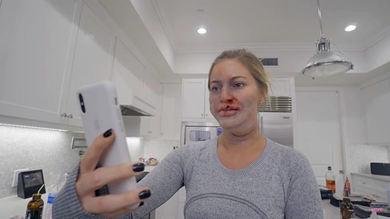 thử nghiệm đánh lừa face id trên iphone x khi phẫu thuật thẩm mỹ và gặp tai nạn Screenshot (231)