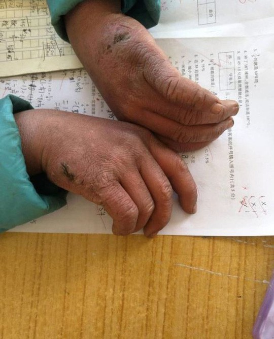 photo-1-1515655529363