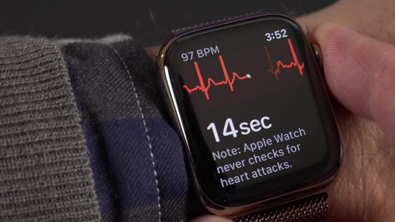 ECG-Apple-Watch-Series-6-Viet-Nam-1