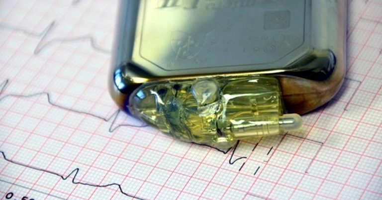 máy tạo nhịp tim