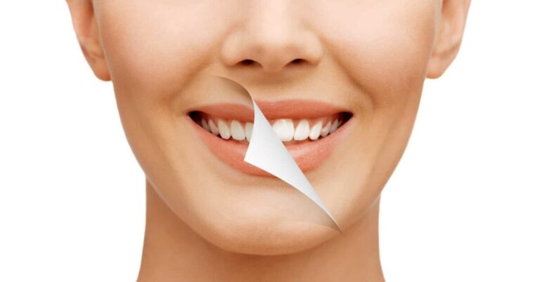 cac-cach-lam-trang-rang-tai-nha-khoa-hoc-an-toan-va-de-thuc-hien