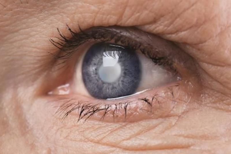 Những tác hại của ánh sáng xanh đối với đôi mắt anh-sang-xanh-la-gi-6