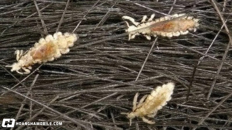 10-cach-tri-chay-don-gian-hieu-qua-an-toan-tai-nha-cho-be-va-nguoi-lon-11