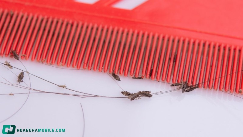 10-cach-tri-chay-don-gian-hieu-qua-an-toan-tai-nha-cho-be-va-nguoi-lon-6