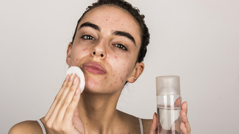 cac-buoc-skincare-cho-da-mun-7