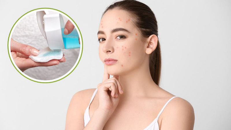 cac-buoc-skincare-cho-da-mun-8