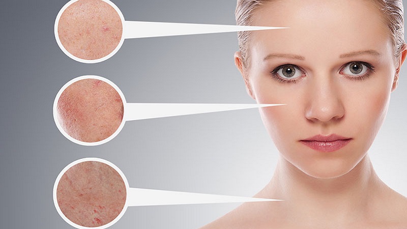 cac-buoc-skincare-cho-da-mun-9