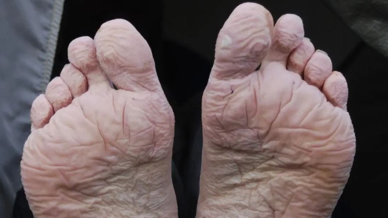 ngam-chan-nuoc-gung-8