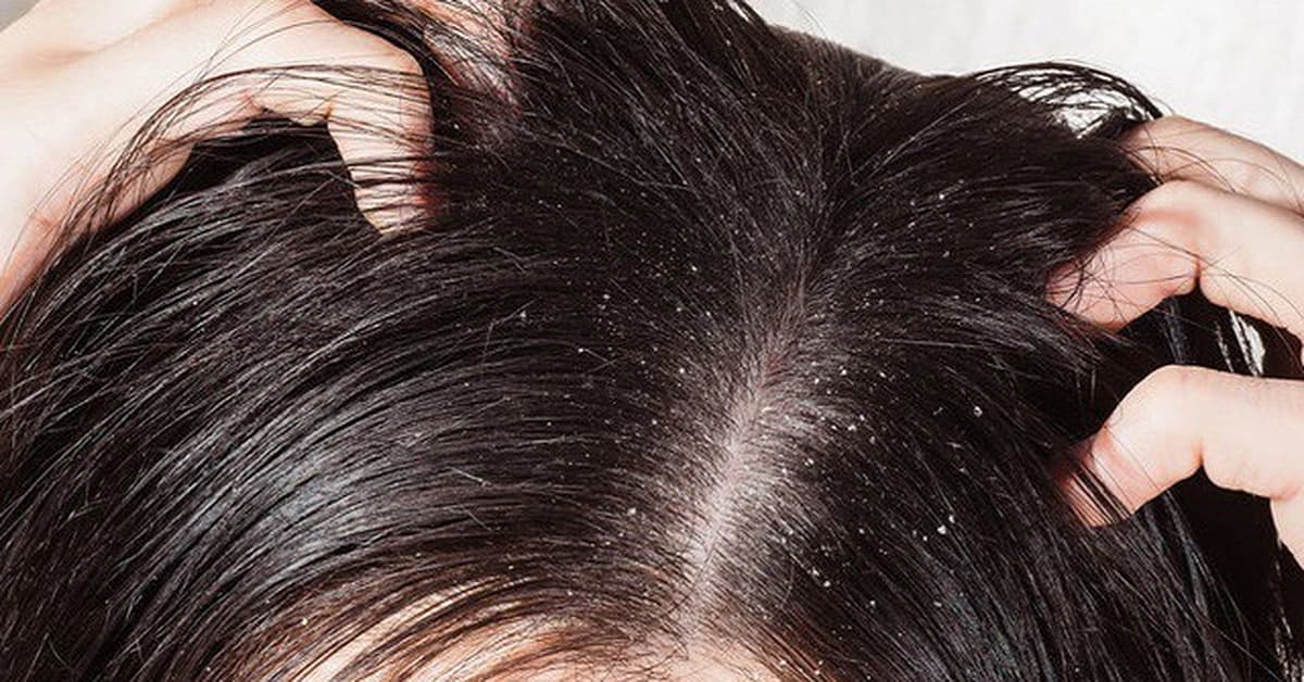 cach-tri-chay-nhanh-nhat