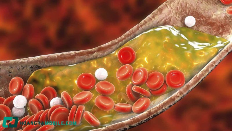 cholesterol-la-gi-2