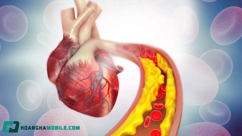 cholesterol-la-gi-3