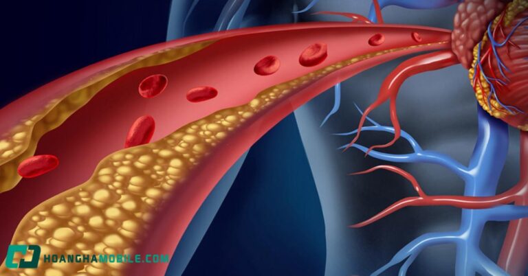 cholesterol-la-gi